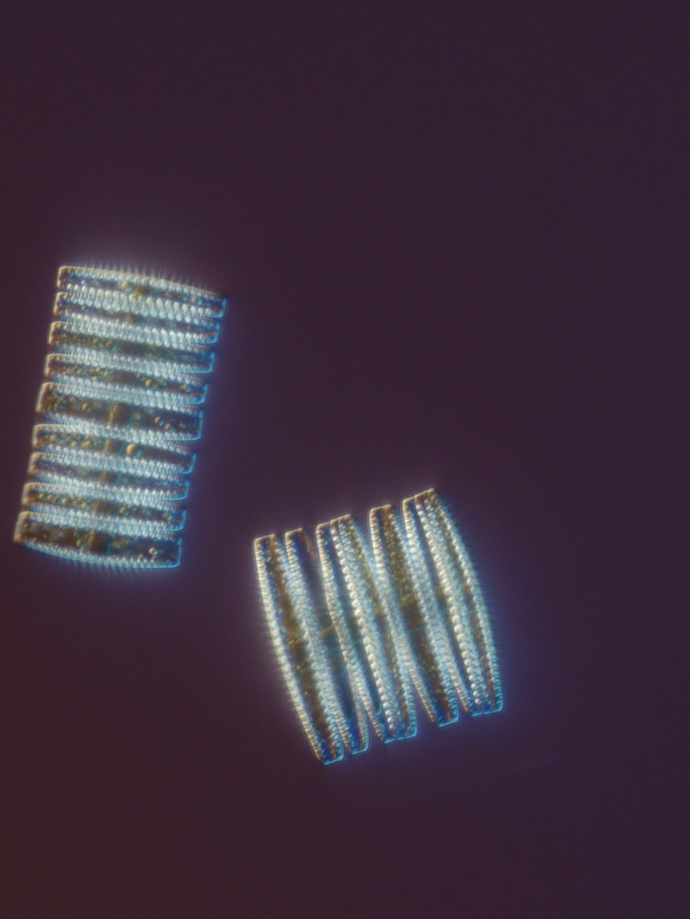 Microscopic view of diatoms